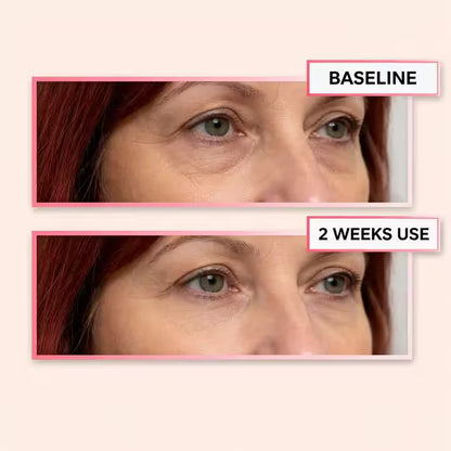 LumiEye Red Light Therapy Device