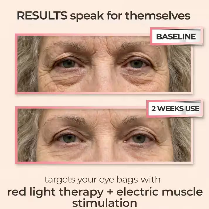 LumiEye Red Light Therapy Device