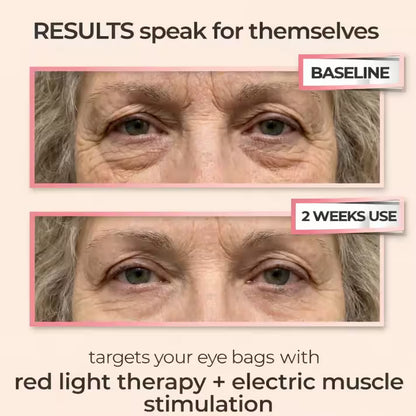LumiEye Red Light Therapy Device